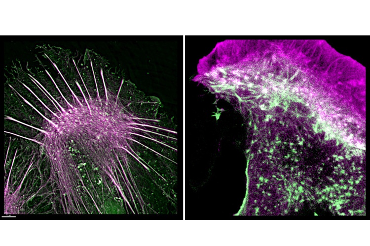 A new way for scientists to see how cells move