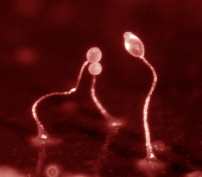 A simple amoeba holds key to better Alzheimer’s treatment