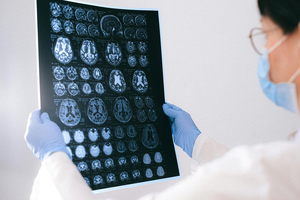 AbbVie to bolster its neuroscience pipeline with $1.4bn Aliada Therapeutics acquisition