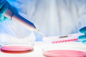 Abzena and UGA Biopharma collaborate to treat MS