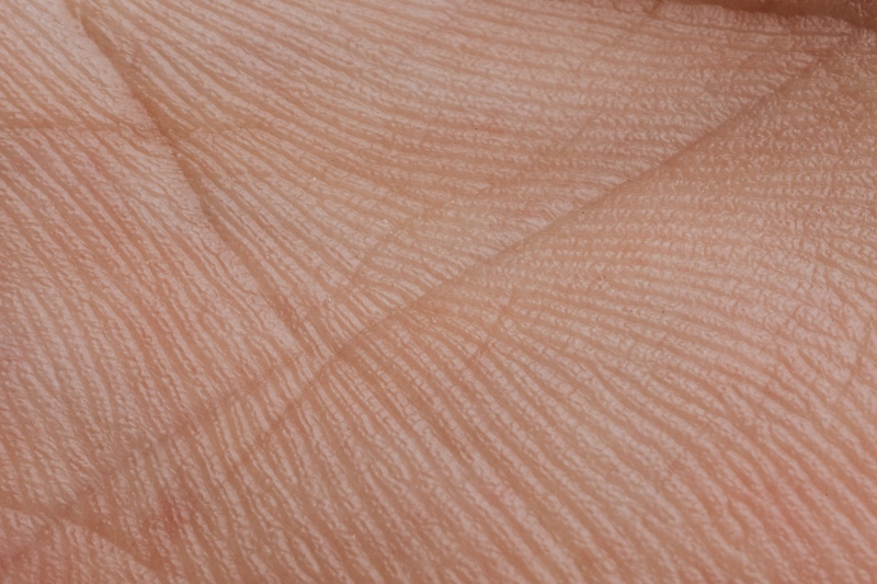 Alys Pharmaceuticals launches to advance findings in immuno-dermatology