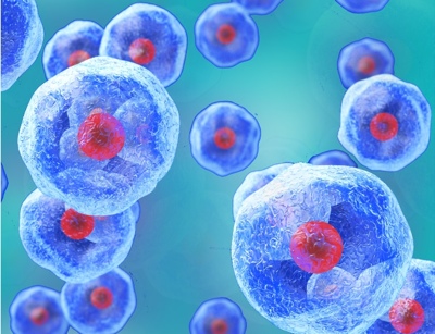 AMS Biotechnology offers device for removal of dying and dead cells