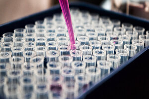 Aptamer and Bio-Works collaborate on gene therapy scale up project 
