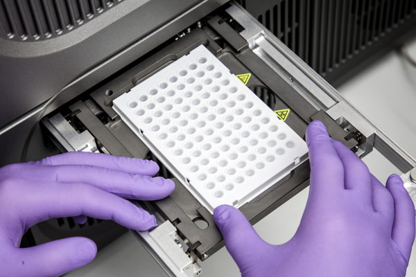 Arcis Biotechnology launches IVD for the preparation of DNA from blood