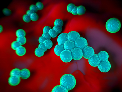 MRSA superbug (Staphylococcus aureus), a famous example of antimicrobial resistance