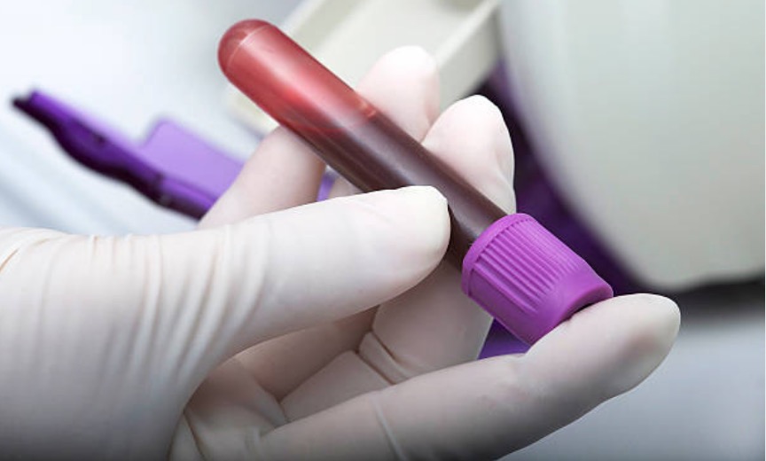 Blood test could predict response to new breast cancer treatment