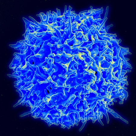 Scanning electron micrograph of a human T lymphocyte (also called a T-cell) from the immune system of a healthy donor<br>Credit: NIAID