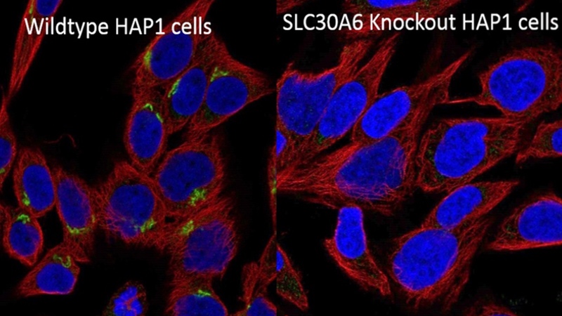 Green - SLC30A6; Blue - nucleus; Red - microtubules