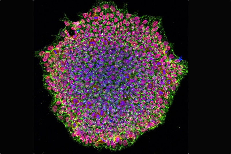 How iPSCs can bridge the translational gap in neuroscience