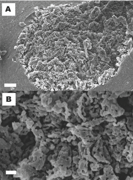 Figure 1 Electron microscopy images of Upsalite. a) SEM micrograph. Scale bar, 1µm; b) Higher magnification SEM clearly showing the textural porosity of the material. Scale bar, 200nm