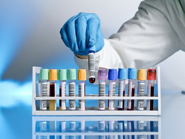 Labels: the surprisingly important role they play in lab testing