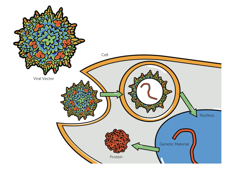 Figure 1: In gene therapy, viral capsids containing the functional gene are delivered to the patient’s cells where the genetic material is then delivered to the nucleus and expressed as a protein. This differs from cell therapy wherein living cells, which may or may not be genetically altered, are delivered to the patient