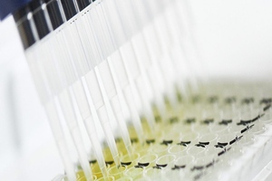 ASIT biotech receives GMP certification for Belgian site 