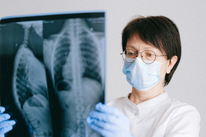 AstraZeneca’s Tagrisso plus chemo for EGFR-mutated lung cancer approved in Japan