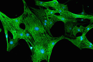 Axiogenesis and Metrion Biosciences announce stem cell collaboration