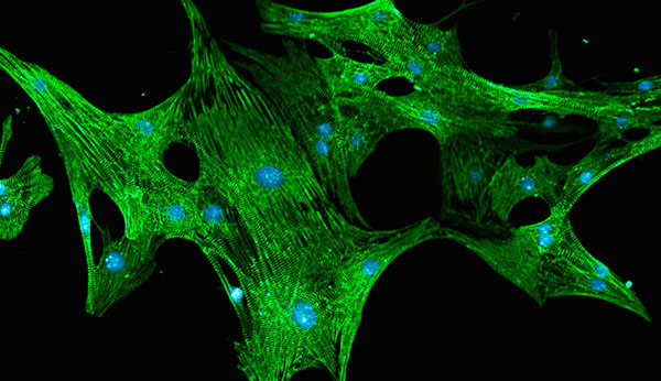 Axiogenesis and Metrion Biosciences announce stem cell collaboration