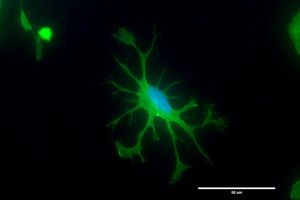 Axol Bioscience launches human iPSC-derived microglia