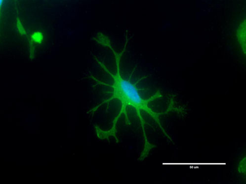 Axol Bioscience launches human iPSC-derived microglia