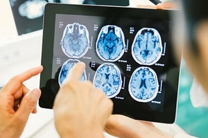 Beactica awarded funding to develop therapeutics against brain tumours
