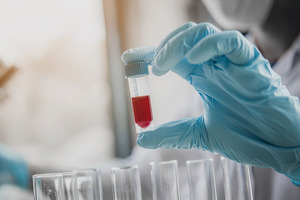 Bio-Rad extends partnership with Gencurix for Droplet digital PCR IVD oncology kits in Europe