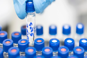 Bio-Rad launches additional COVID-19 immunoassay panels 