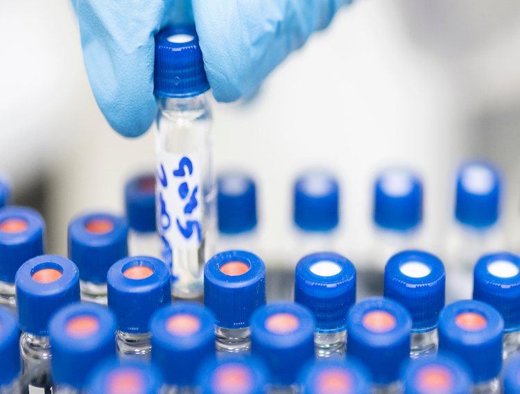 Bio-Rad launches additional COVID-19 immunoassay panels 