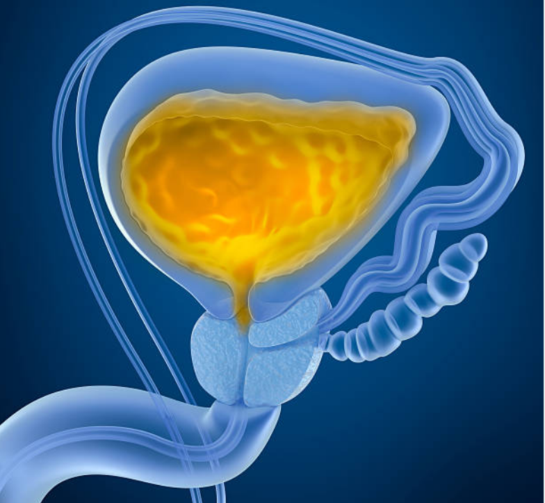 Bladder cancer market to triple by 2025