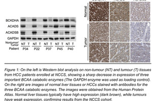 Branched-chain amino acids found to regulate the development and progression of cancer
