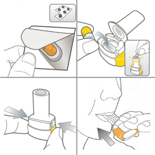 Capsule-based inhalers: part I