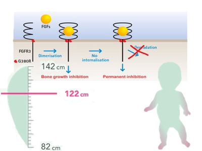 Catalent and Therachon to develop protein therapy for achondroplasia