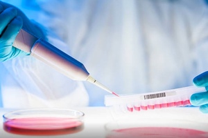 Catalent Biologics adopts Berkeley Lights’ Beacon optofluidic platform 