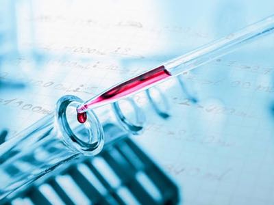 CatSci expands focus to lead optimisation