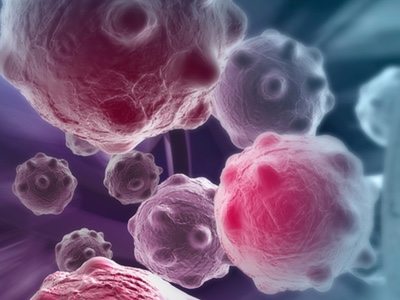 Cell Medica acquires WT1 cancer immunotherapy from CGT Catapult