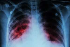 Chemify secures $1.6m Gates Foundation grant to accelerate digital chemistry for tuberculosis drug discovery