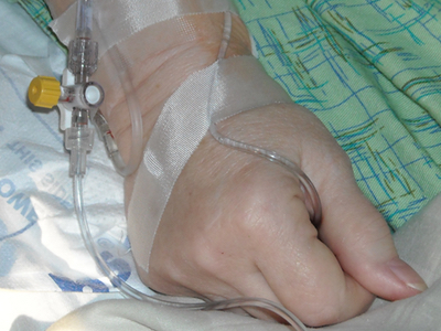 Chemotherapy tablets: the choice of the future
