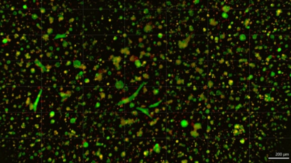 ChristianaCare launches organoid core to personalise cancer treatment in Delaware