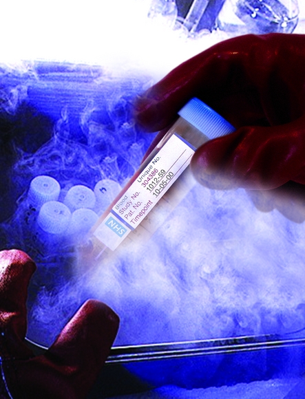 CILS introduces cryogenic storage labels