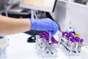 Clearbridge BioMedics joins CANCER-ID consortium 