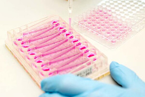 CN Bio introduces PhysioMimix NASH ‘in-a-box’ reagent kit