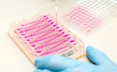 CN Bio introduces PhysioMimix NASH ‘in-a-box’ reagent kit