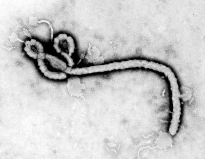 Consortium wins US$28m to find Ebola treatment