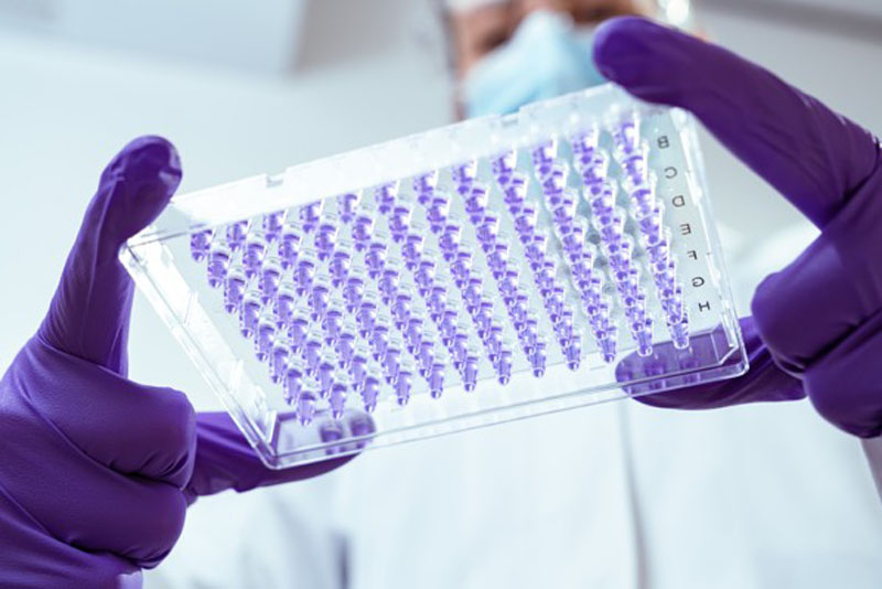 Custom PCR solutions for diagnostic kit manufacturers