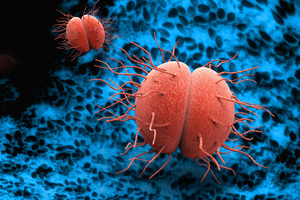 Debiopharm pushes the boundaries of innovation in antibiotic development against gonorrhoea