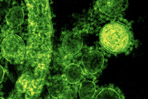 e-FabRIC consortium awarded €7.7m to develop broad-spectrum therapy against viruses with pandemic potential