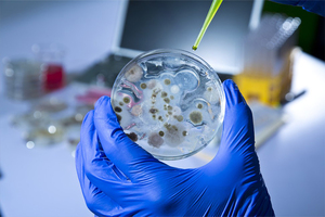 Efficient extraction of proteins from bacterial cells