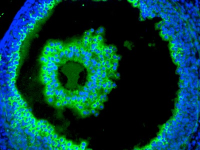 ELISA-like Assay for Hyaluronic Acid