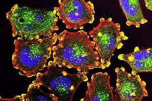 Emmes creates cell and gene therapy research