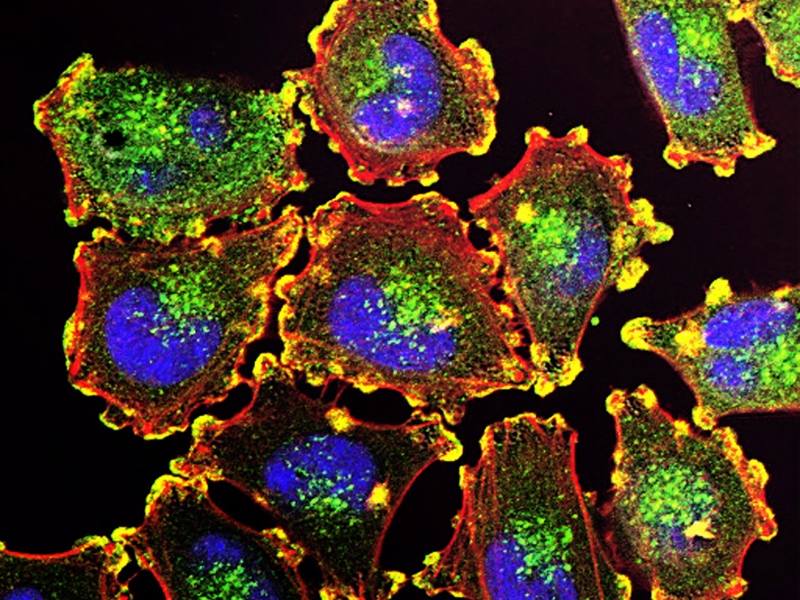 Emmes creates cell and gene therapy research