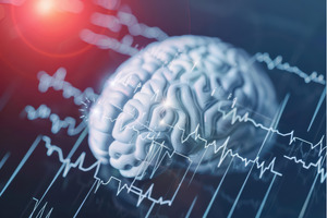 EpilepsyGTx selects ClearPoint Neuro technology for Phase I/IIa epilepsy gene therapy trial