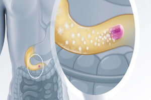 Evonik launches oral drug delivery technology  